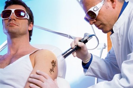 There are some other medical methods of tattoo removal so painful and 